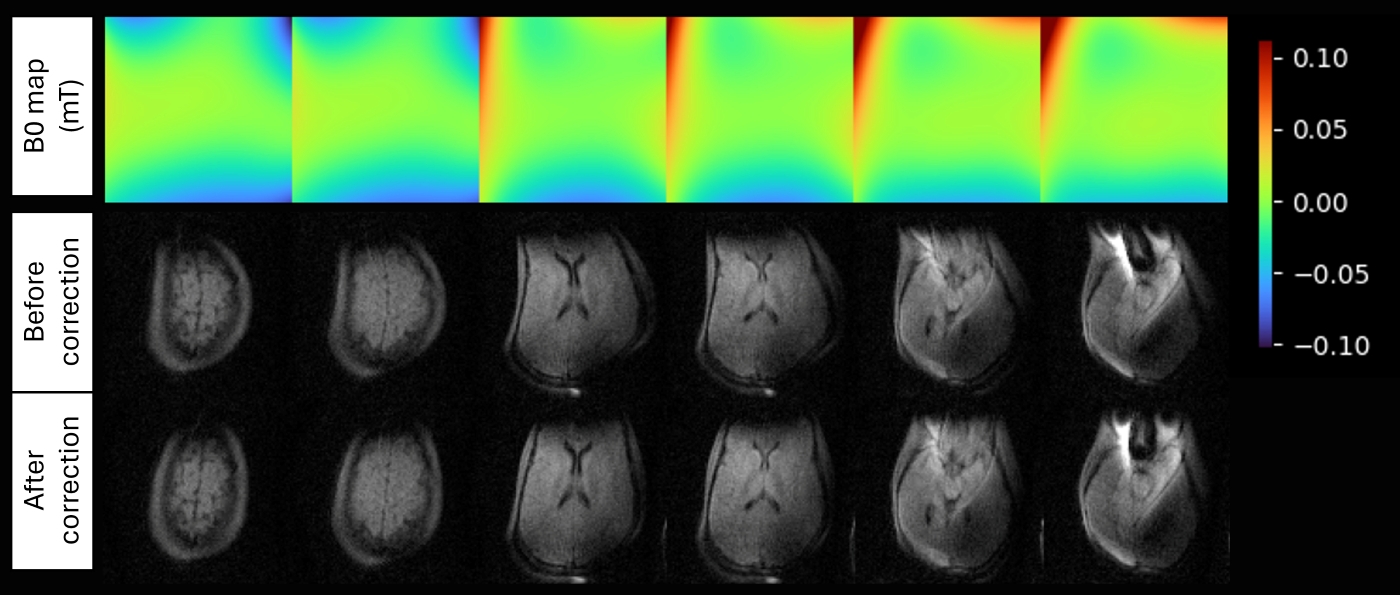 Tyger - portable MRI story: figure 2