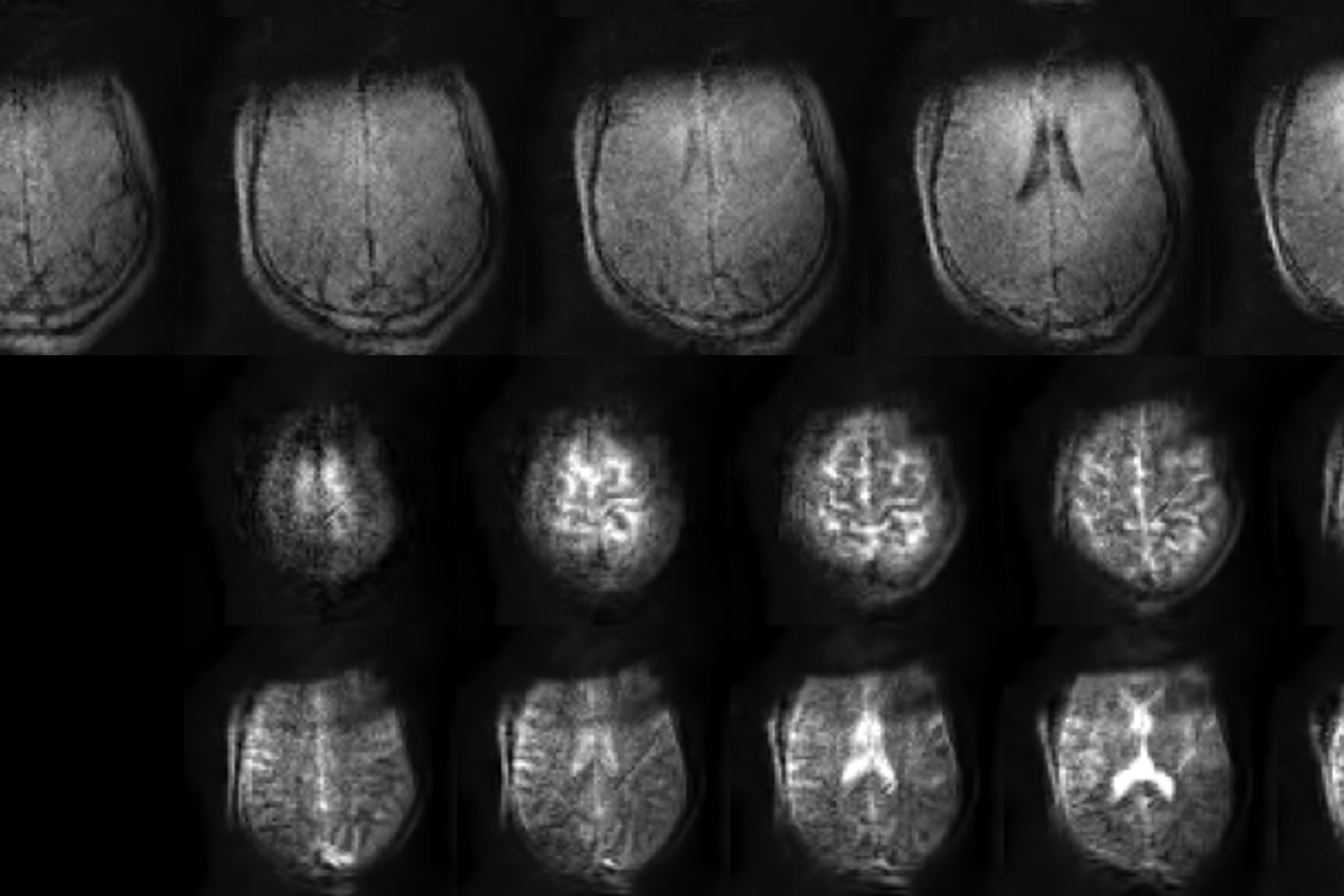 Tyger - portable MRI story: MRI scans